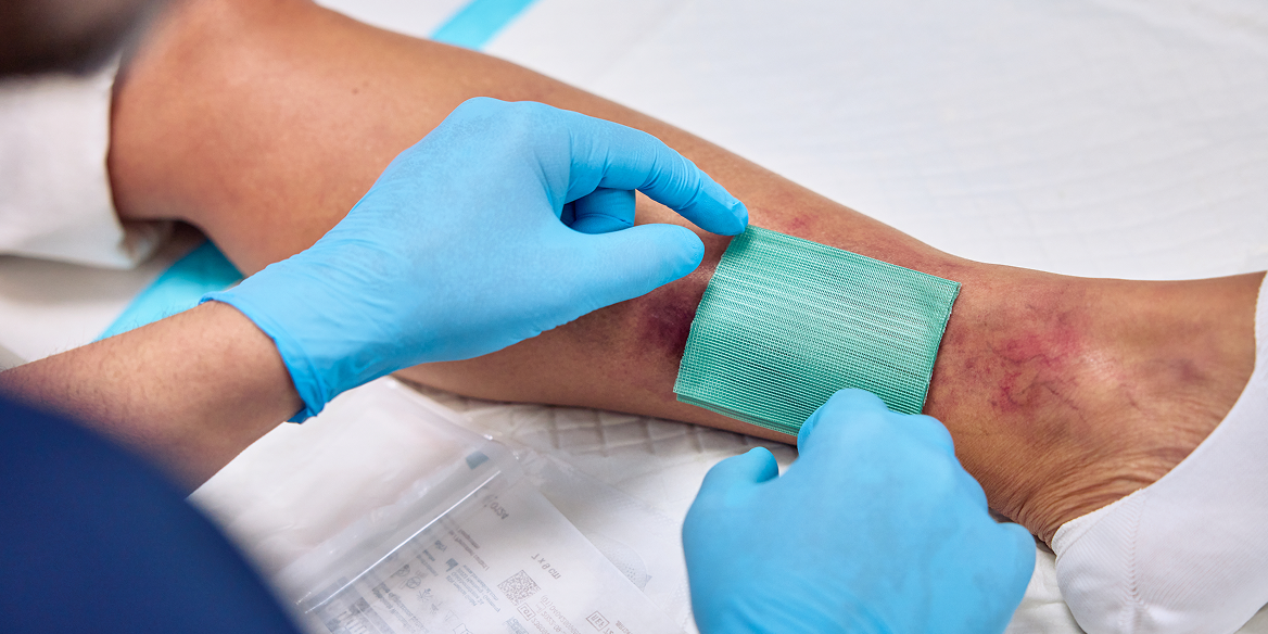 Infektionsmanagement mit Cutimed Sorbact Infektionsmanagement mit Cutimed Sorbact